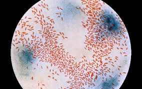 haemophilus parahaemolyticus pneumonia