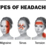 headache disorder