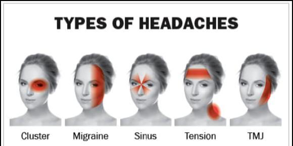 headache disorder