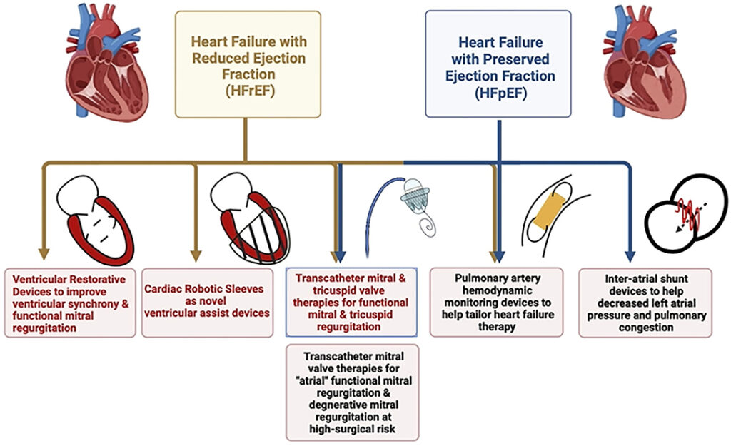 heart failure with reduced ejection fraction due to dilated cardiomyopathy