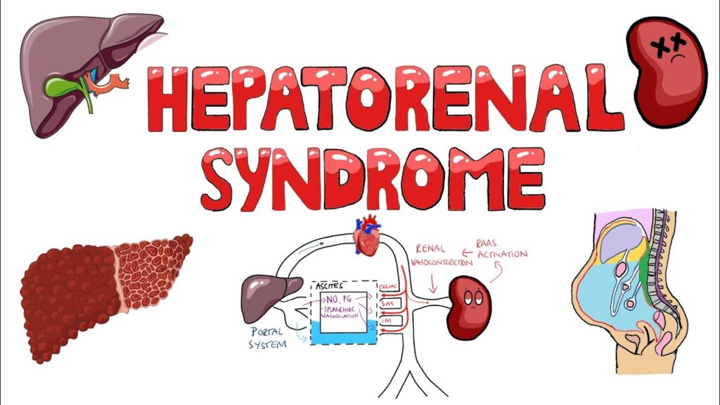 hepatorenal syndrome