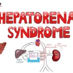 hepatorenal syndrome