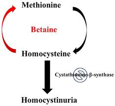 homocystinuria