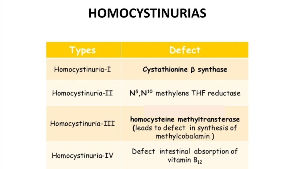 homocystinuria type i