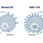 hormone receptor (hr)-positive, her2-negative advanced female breast cancer