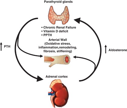 hypercalcemia due to primary hyperparathyroidism