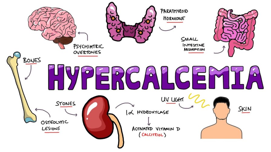 hypercalcemia