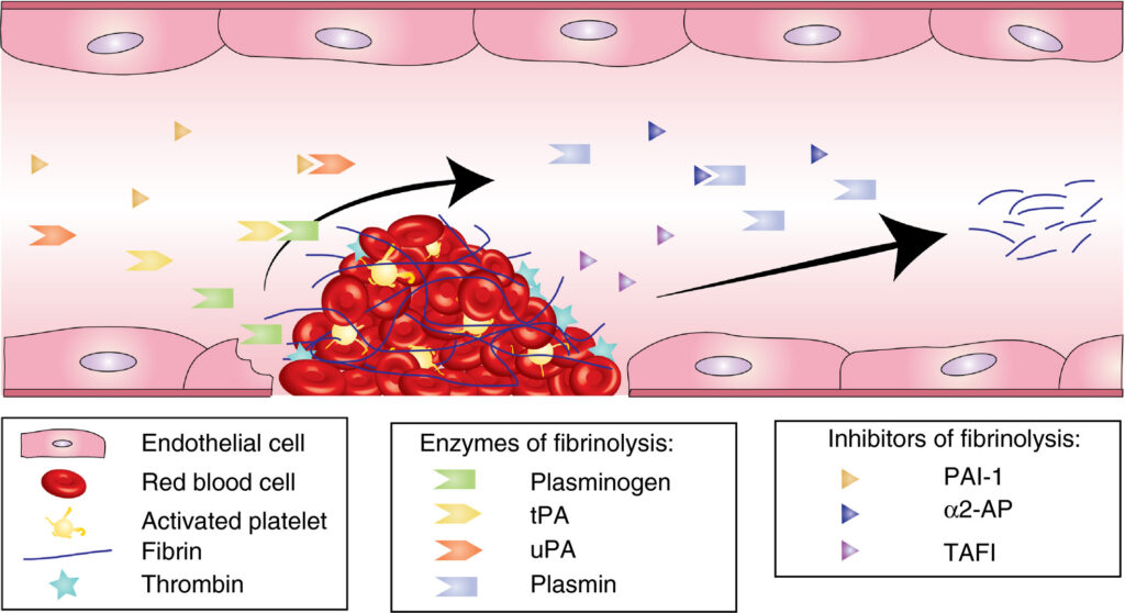 hyperfibrinolysis-induced hemorrhage