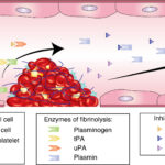 hyperfibrinolysis-induced hemorrhage