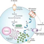 hyperinsulinism