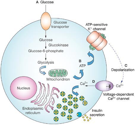 hyperinsulinism