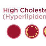 hyperlipidemia