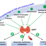 hyperparathyroidism secondary to chronic renal failure