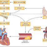 hyperparathyroidism secondary to chronic renal failure with dialysis