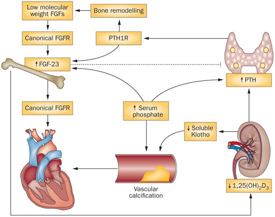 hyperparathyroidism secondary to chronic renal failure with dialysis