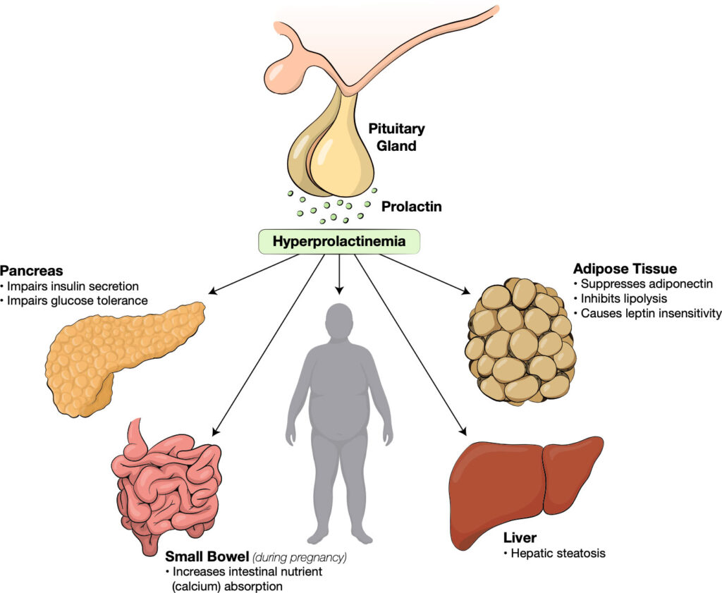 hyperprolactinemia