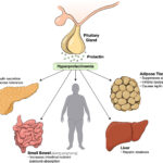 hyperprolactinemia