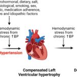 hypertension with left ventricular hypertrophy