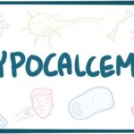 hypocalcemia