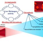 hypofibrinogenemia