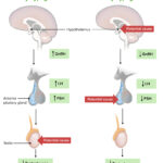 hypogonadotropic hypogonadism