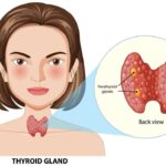 hypoparathyroidism