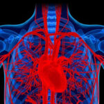 hypotension due to distributive shock