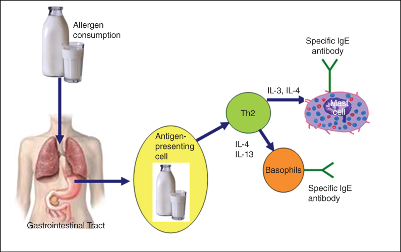 ige-mediated food allergy