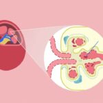 immunoglobulin a nephropathy