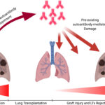 immunosuppression therapy for lung transplant