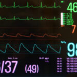 induction of intraoperative hypotension