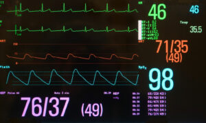 induction of intraoperative hypotension