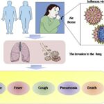 influenza due to influenza virus type a