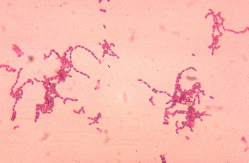 intra abdominal peptococcus abscess