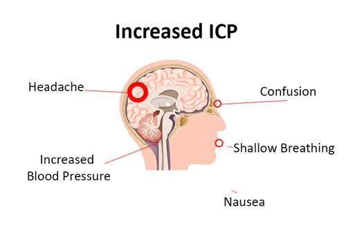 intracranial hypertension