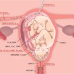 postpartum endomyometritis due to porphyromonas