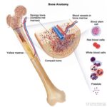 progressive chronic lymphocytic leukemia