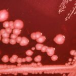 proteus pneumonia