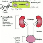 proteus pyelonephritis