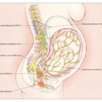 regional anesthesia for labor pain