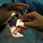 regional anesthesia for ophthalmologic surgery
