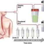 secretin stimulation testing