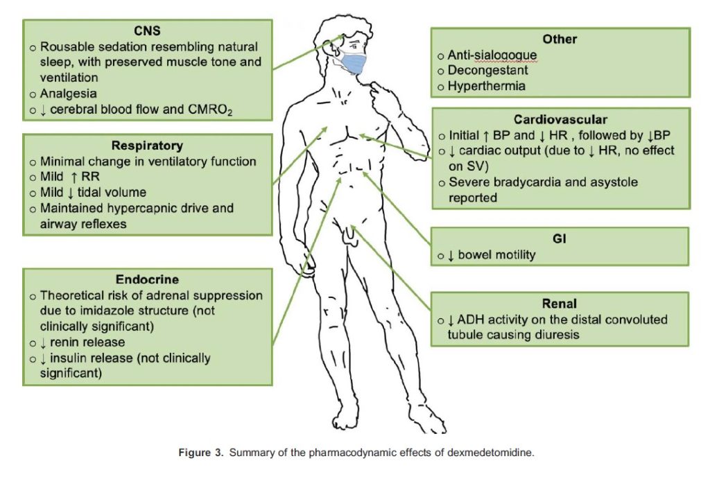 sedation as adjunct to anesthesia