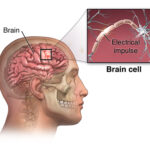 seizure disorder