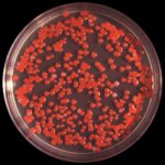 serratia meningitis