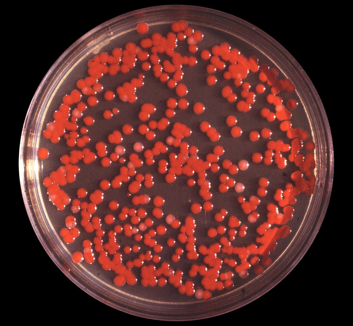 serratia meningitis