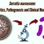 serratia pneumonia