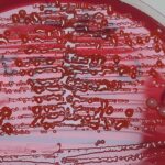 serratia urinary tract infection