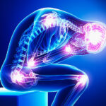 severe chronic pain