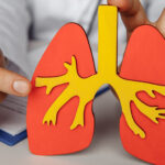 severe persistent asthma